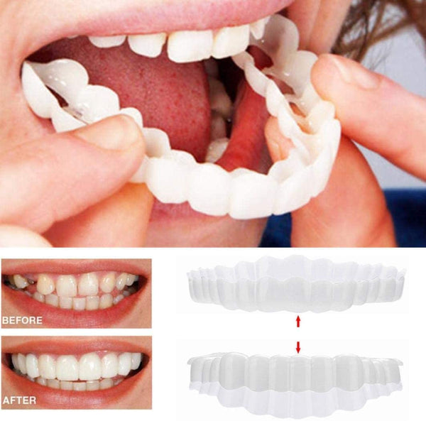 Sofort wirkende Veneers-Zahnblende - Mit Ober- und Unterkieferteil