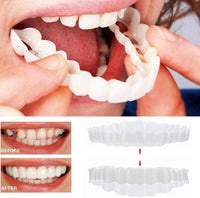 Sofort wirkende Veneers-Zahnblende - Mit Ober- und Unterkieferteil