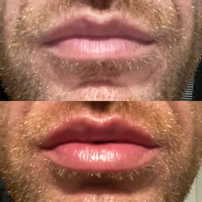 Sofortiges Lippen-Volumen-Serum