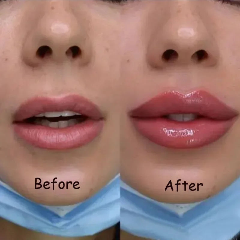 Sofortiges Lippen-Volumen-Serum