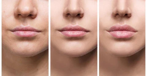 Sofortiges Lippen-Volumen-Serum