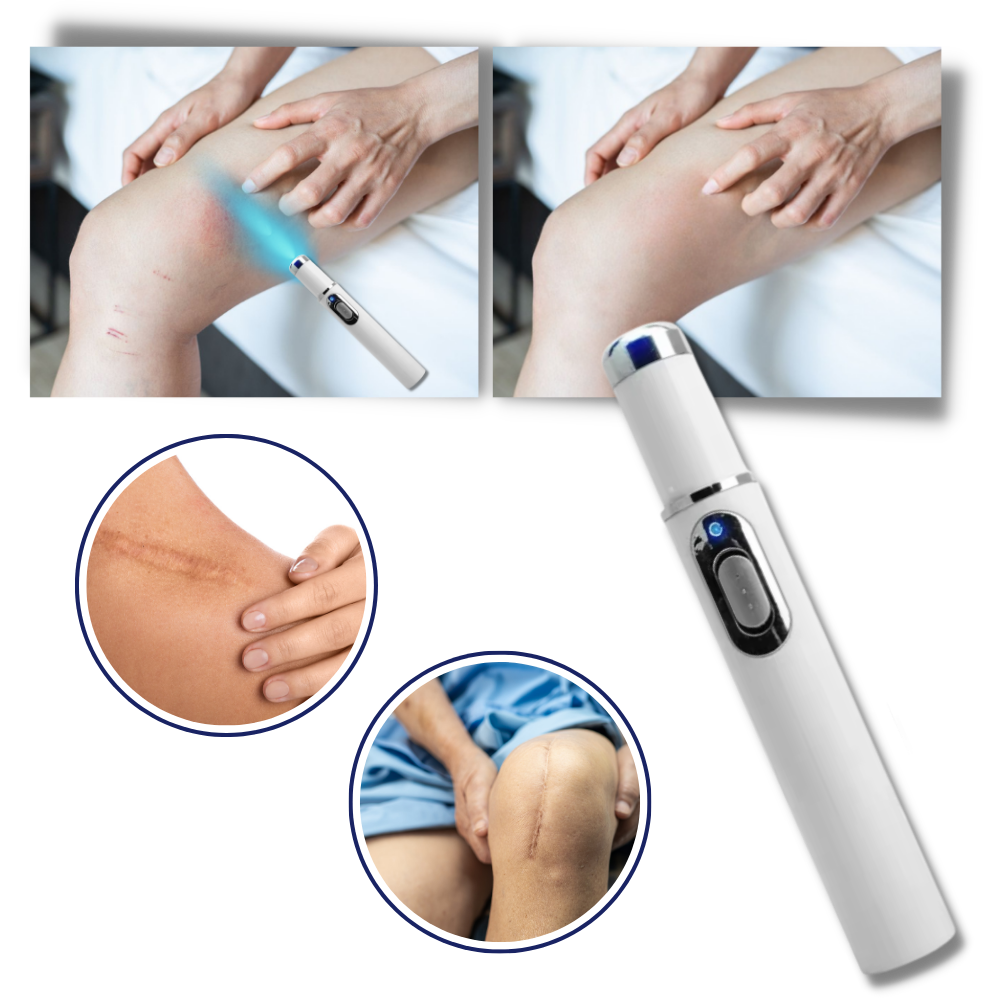 Blaulicht-Laserstift für ein ebenmässigeres Hautbild