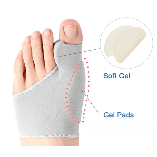 Hallux-valgus-Korrektor für Teenager, diskret und bequem, aus weichem hautfarbenem Material – schmerzlindernd