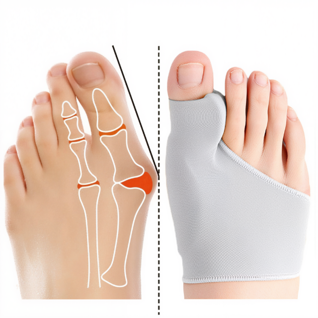 Gel-Hallux-valgus-Korrektor zur Linderung von Fussschmerzen