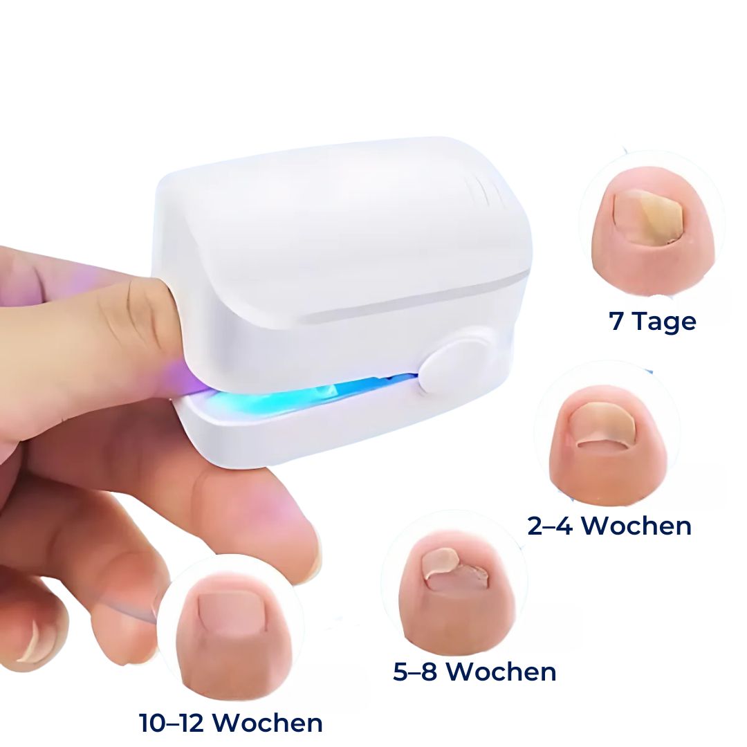 Laser-Nagelpilz-Gerät - Schmerzfrei und wirksam
