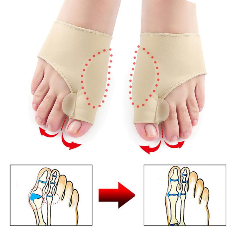 Orthopädische Hallux-valgus-Korrekturbandage (1 Paar)