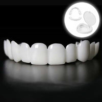 Snap-on Veneers – Sofortige Lächelnkorrektur gegen ästhetische Makel