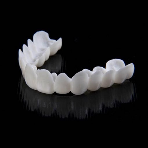Snap-on Veneers – Sofortige Lächelnkorrektur gegen ästhetische Makel