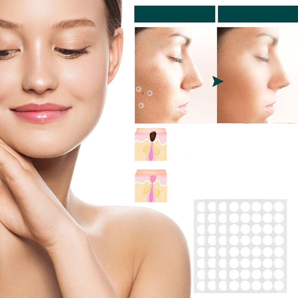 SkinClear Pflaster zur Entfernung von Hautanhängseln und Warzen | Hydrokolloid-Technologie | Schmerzfrei und diskret | Für alle Hauttypen | 120 Stück