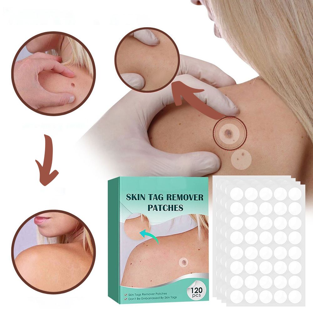 SkinClear Pflaster zur Entfernung von Hautanhängseln und Warzen | Hydrokolloid-Technologie | Schmerzfrei und diskret | Für alle Hauttypen | 120 Stück